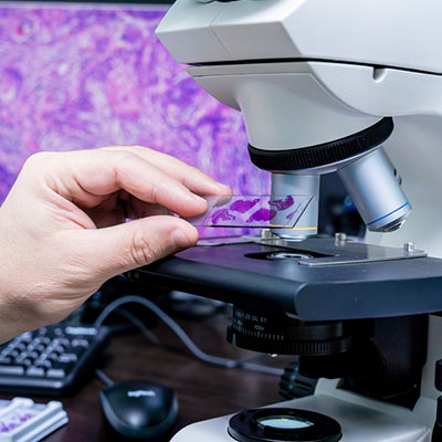 Cytology / FNAC